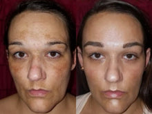 Load image into Gallery viewer, MVB RITUAL SKIN CARE